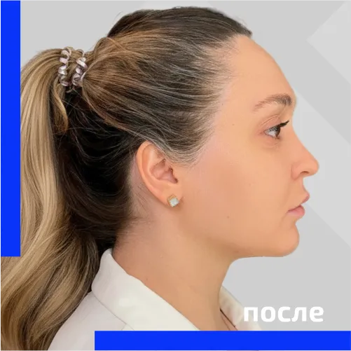  планшет после2