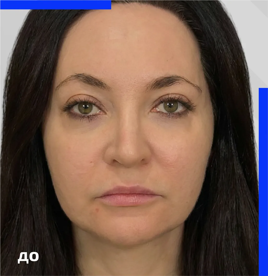 morpheus_galb_before