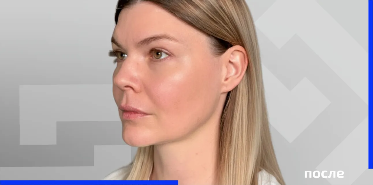  после морфиус5